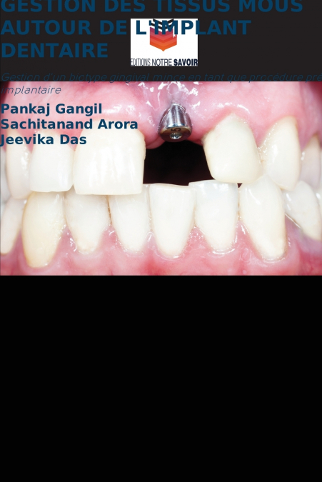 GESTION DES TISSUS MOUS AUTOUR DE L’IMPLANT DENTAIRE