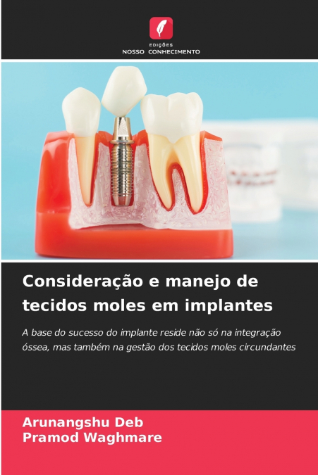 Consideração e manejo de tecidos moles em implantes
