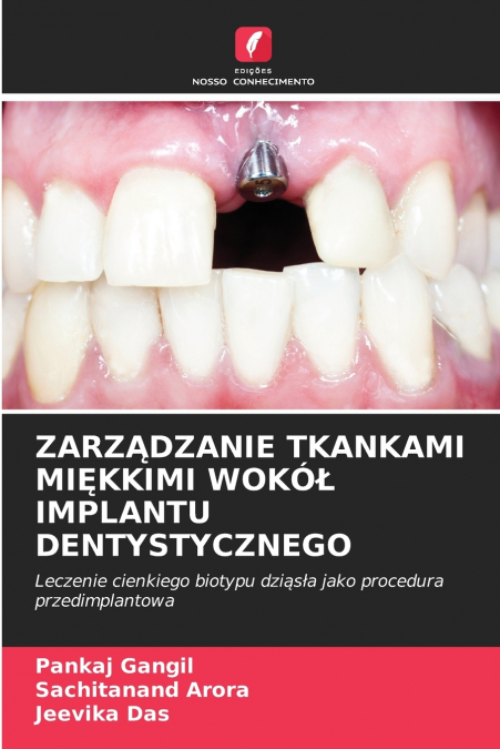 ZARZĄDZANIE TKANKAMI MIĘKKIMI WOKÓŁ IMPLANTU DENTYSTYCZNEGO