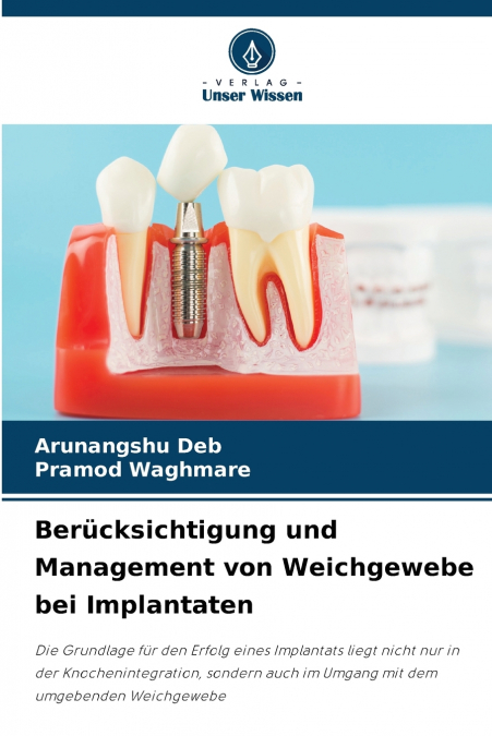 Berücksichtigung und Management von Weichgewebe bei Implantaten