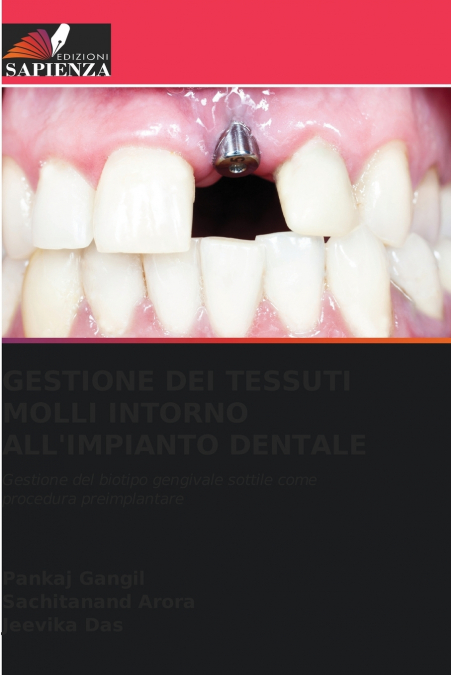 GESTIONE DEI TESSUTI MOLLI INTORNO ALL’IMPIANTO DENTALE