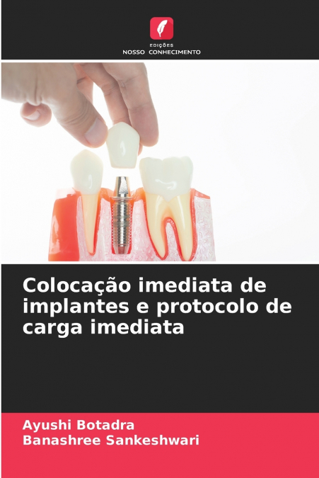 Colocação imediata de implantes e protocolo de carga imediata