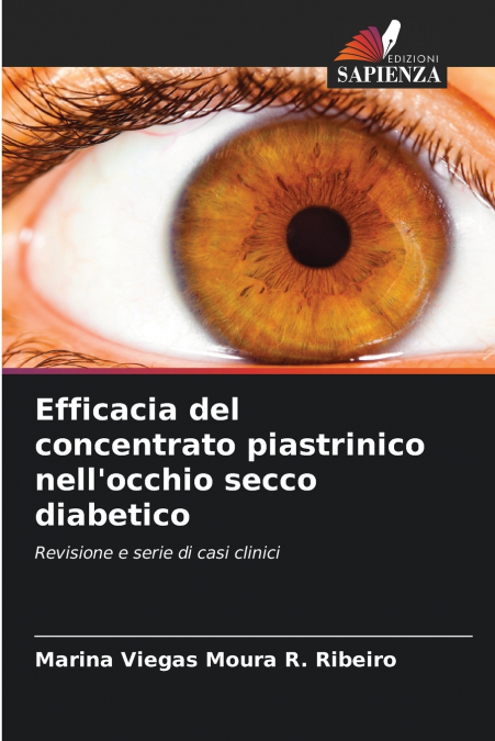 Efficacia del concentrato piastrinico nell’occhio secco diabetico