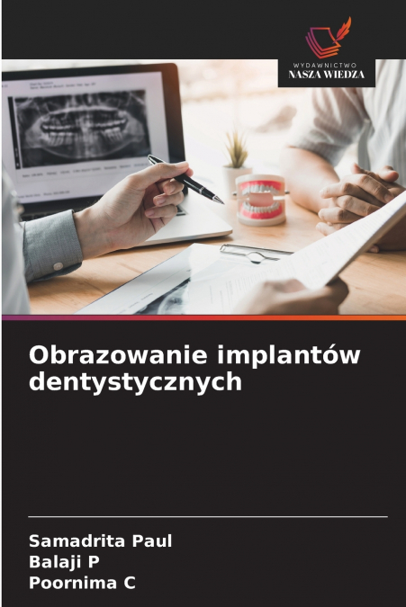 Obrazowanie implantów dentystycznych