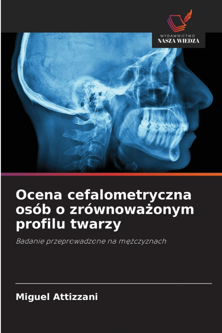 Ocena cefalometryczna osób o zrównoważonym profilu twarzy