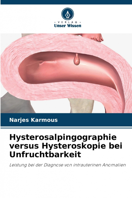 Hysterosalpingographie versus Hysteroskopie bei Unfruchtbarkeit