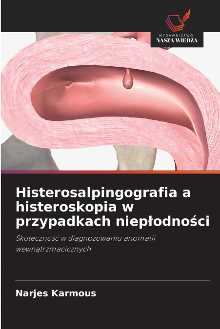 Histerosalpingografia a histeroskopia w przypadkach niepłodności
