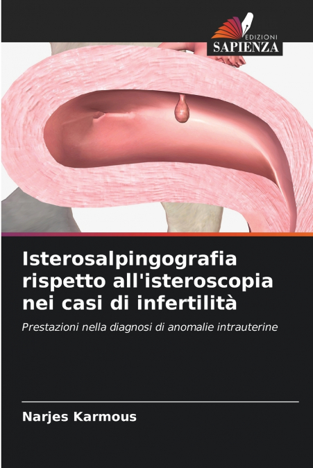 Isterosalpingografia rispetto all’isteroscopia nei casi di infertilità