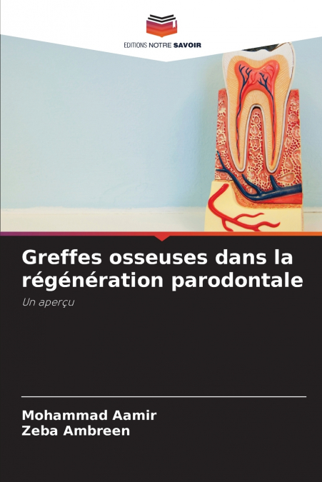 Greffes osseuses dans la régénération parodontale
