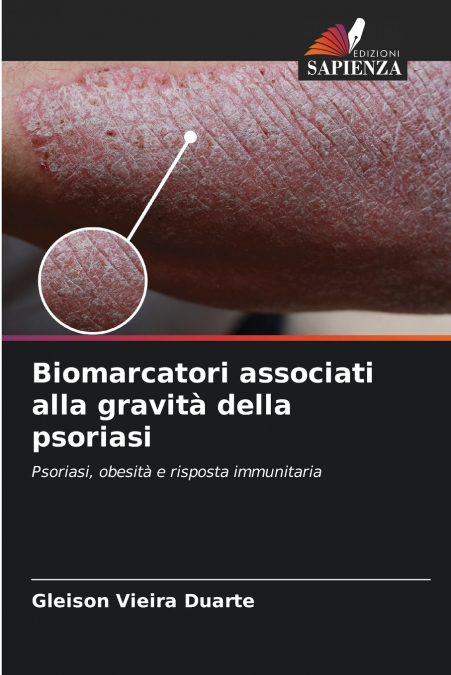 Biomarcatori associati alla gravità della psoriasi