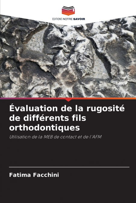 Évaluation de la rugosité de différents fils orthodontiques
