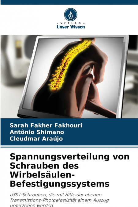 Spannungsverteilung von Schrauben des Wirbelsäulen-Befestigungssystems