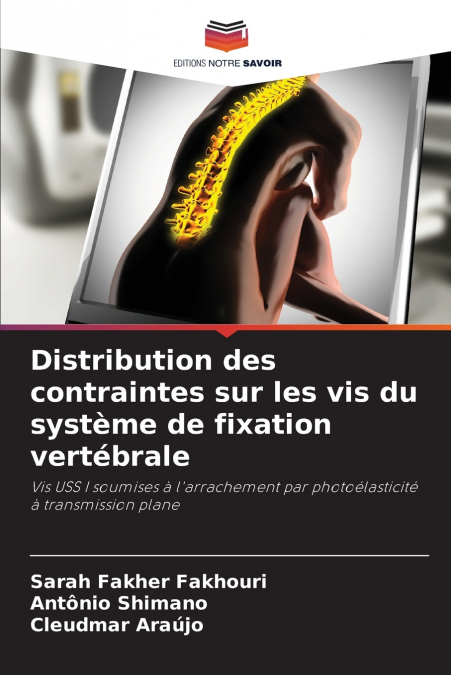 Distribution des contraintes sur les vis du système de fixation vertébrale