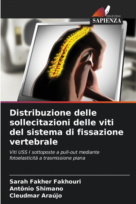 Distribuzione delle sollecitazioni delle viti del sistema di fissazione vertebrale