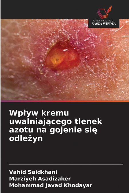 Wpływ kremu uwalniającego tlenek azotu na gojenie się odleżyn