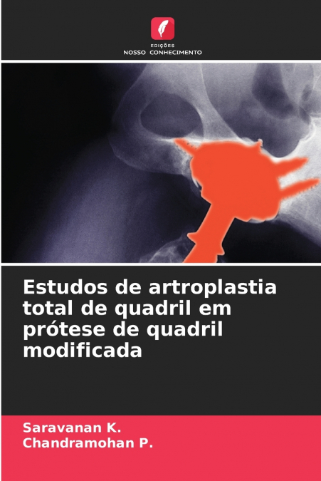 Estudos de artroplastia total de quadril em prótese de quadril modificada