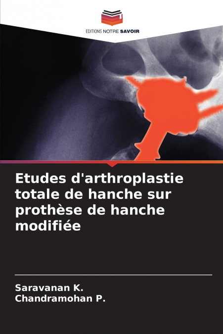 Etudes d’arthroplastie totale de hanche sur prothèse de hanche modifiée
