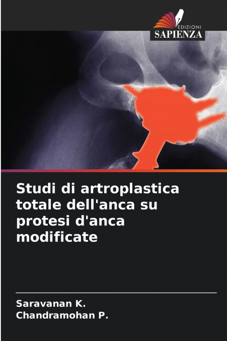 Studi di artroplastica totale dell’anca su protesi d’anca modificate