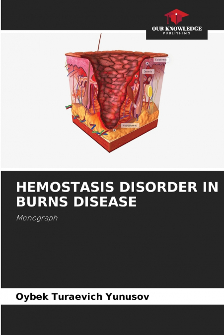HEMOSTASIS DISORDER IN BURNS DISEASE