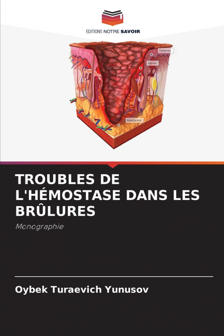 TROUBLES DE L’HÉMOSTASE DANS LES BRÛLURES
