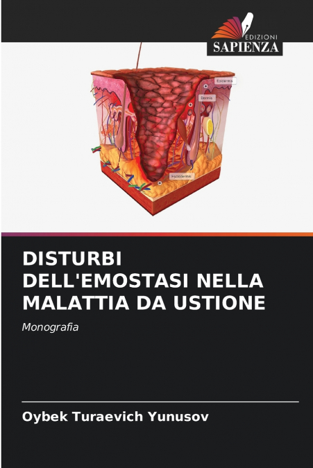 DISTURBI DELL’EMOSTASI NELLA MALATTIA DA USTIONE