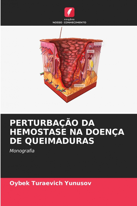 PERTURBAÇÃO DA HEMOSTASE NA DOENÇA DE QUEIMADURAS