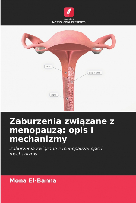 Zaburzenia związane z menopauzą