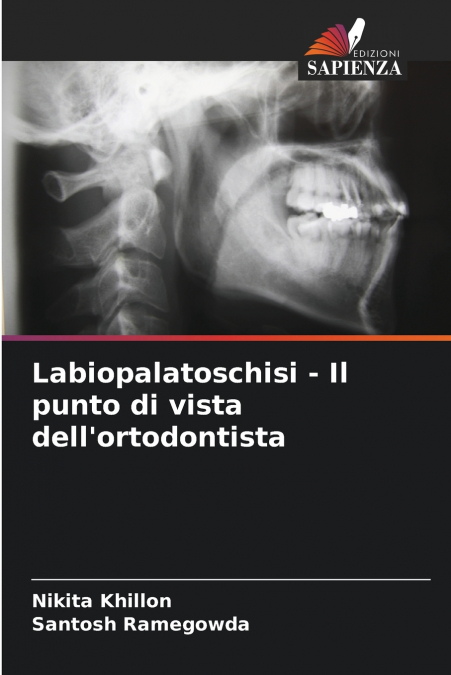Labiopalatoschisi - Il punto di vista dell’ortodontista