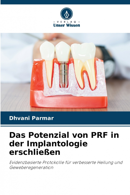 Das Potenzial von PRF in der Implantologie erschließen