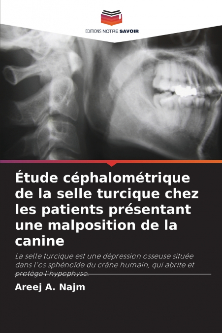 Étude céphalométrique de la selle turcique chez les patients présentant une malposition de la canine