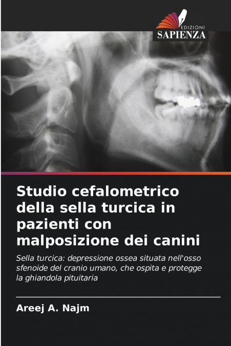 Studio cefalometrico della sella turcica in pazienti con malposizione dei canini