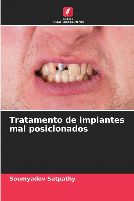 Tratamento de implantes mal posicionados