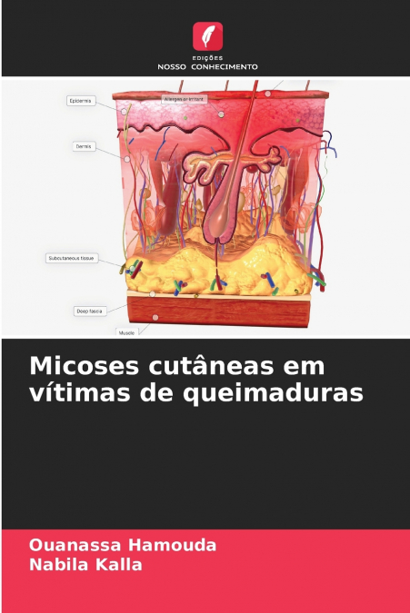 Micoses cutâneas em vítimas de queimaduras