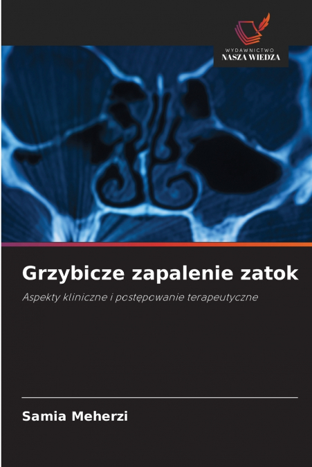 Grzybicze zapalenie zatok