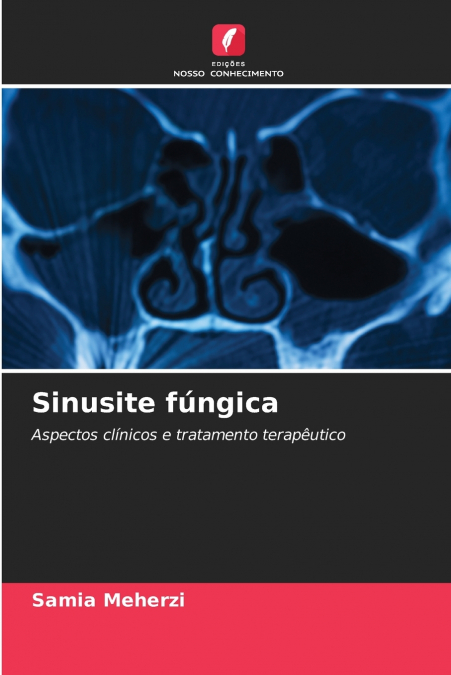 Sinusite fúngica
