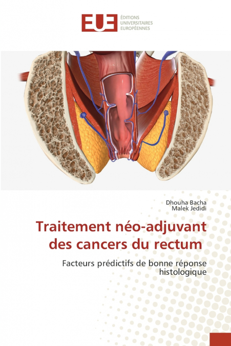 Traitement néo-adjuvant des cancers du rectum
