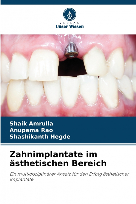 Zahnimplantate im ästhetischen Bereich