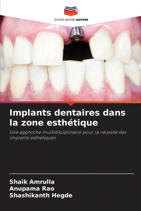 Implants dentaires dans la zone esthétique