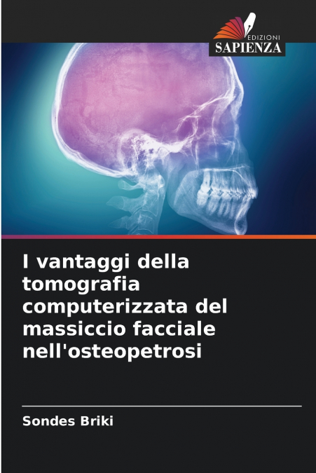 I vantaggi della tomografia computerizzata del massiccio facciale nell’osteopetrosi