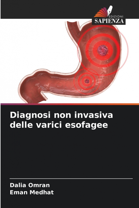 Diagnosi non invasiva delle varici esofagee