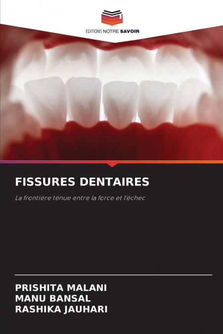 FISSURES DENTAIRES