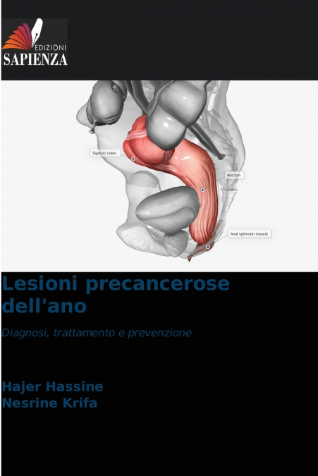 Lesioni precancerose dell’ano