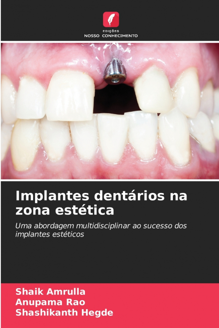 Implantes dentários na zona estética