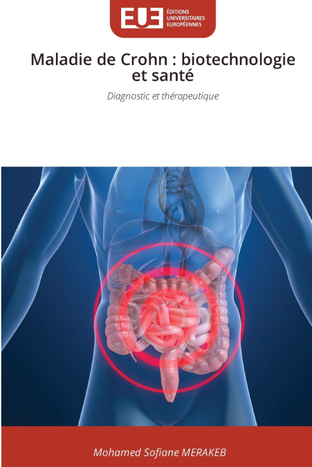 Maladie de Crohn