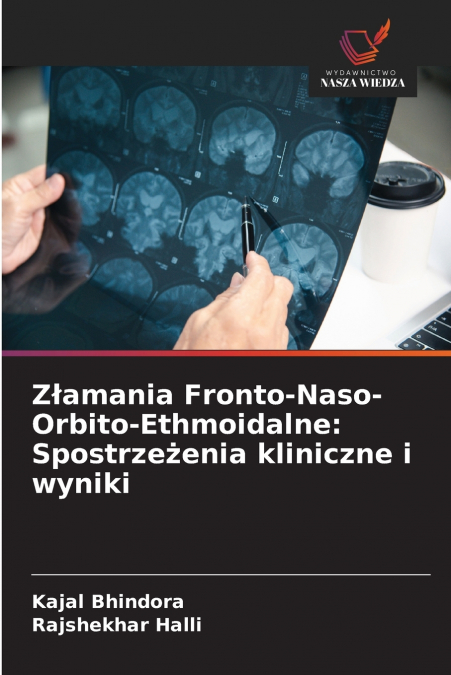 Złamania Fronto-Naso-Orbito-Ethmoidalne