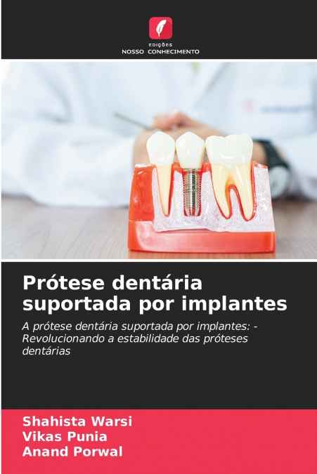 Prótese dentária suportada por implantes