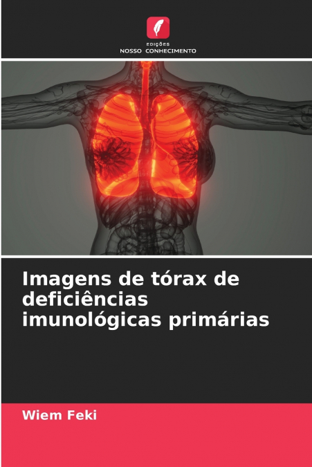 Imagens de tórax de deficiências imunológicas primárias