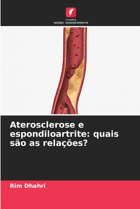 Aterosclerose e espondiloartrite
