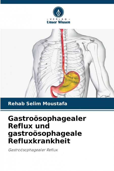 Gastroösophagealer Reflux und gastroösophageale Refluxkrankheit