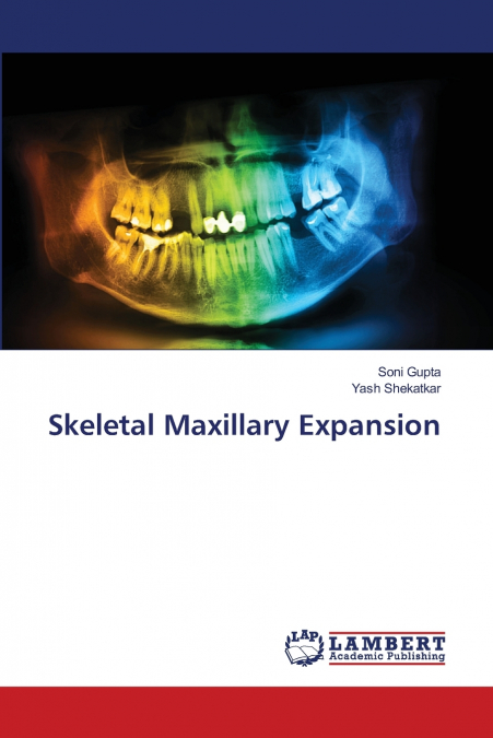 Skeletal Maxillary Expansion
